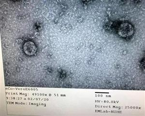 Việt Nam nuôi cấy và phân lập thành công virus corona chủng mới