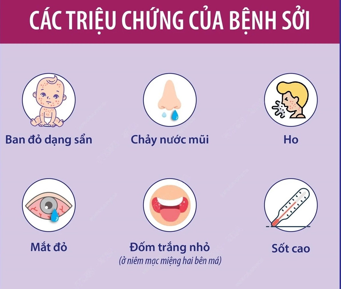 Bệnh sởi: Triệu chứng và cách phòng tránh