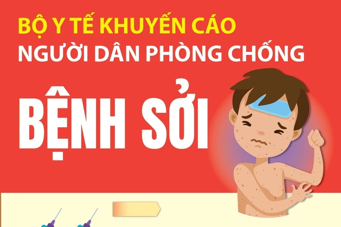 Bộ Y tế khuyến cáo người dân về nguy cơ lây nhiễm bệnh sởi